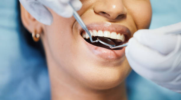 Best Emergency Orthodontic Repairs in Davis, CA